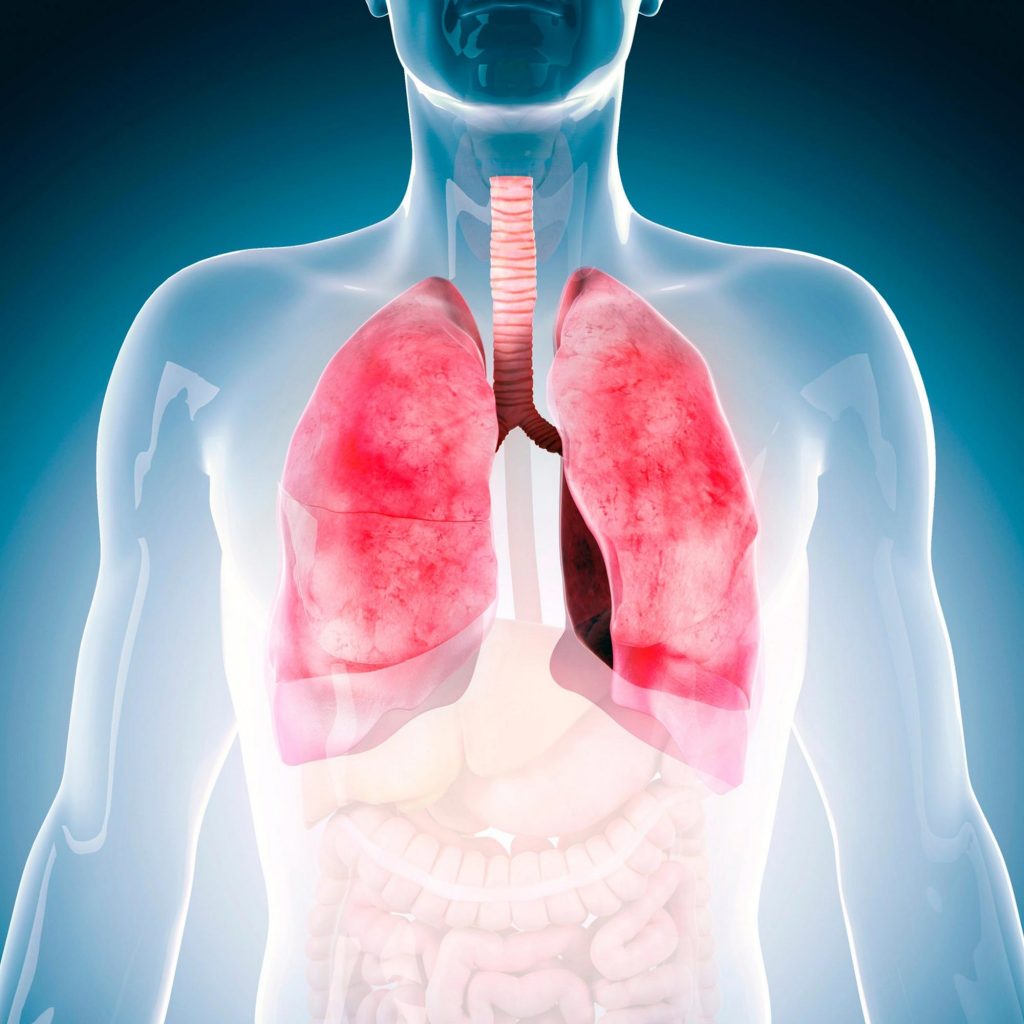 Asthma and Emphysema